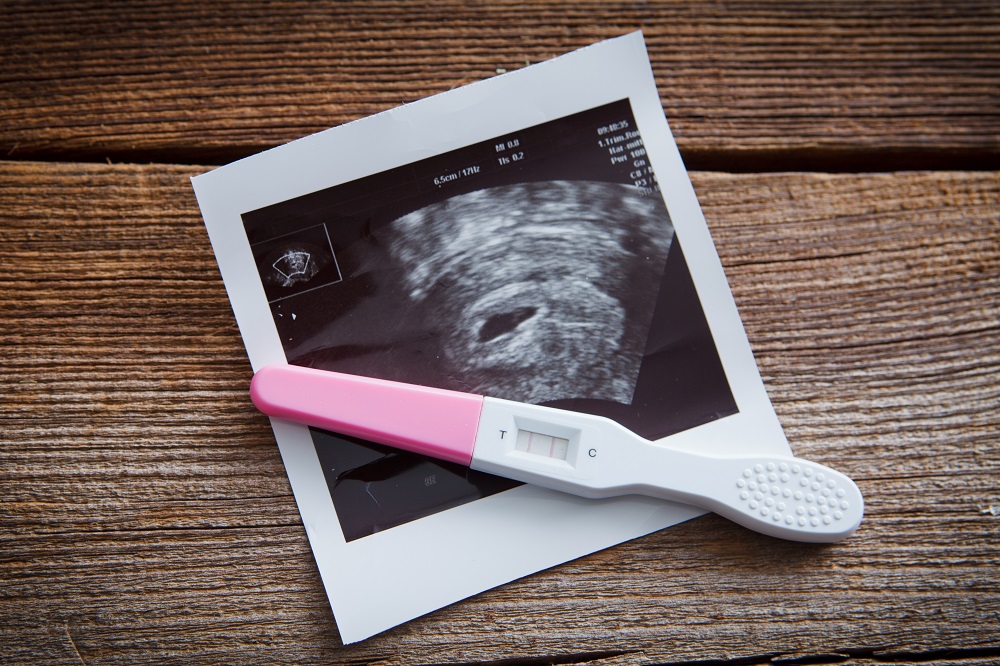 positiver schwangerschaftstest liegt neben ultraschallbild eines babys